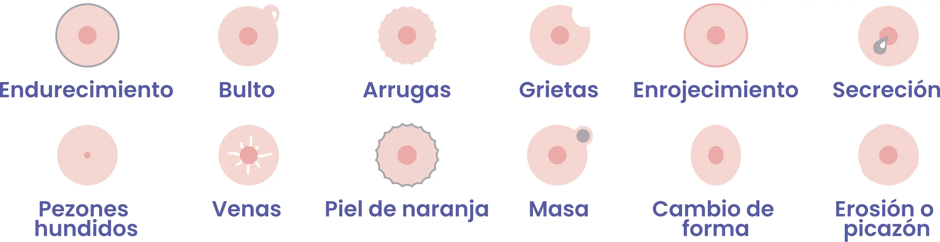 Ilustración síntomas Cáncer de mama